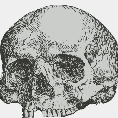 Medical Skull 3 Thumbnail