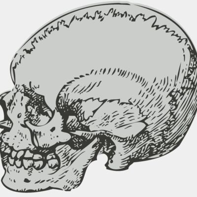 Medical Skull 5 Thumbnail