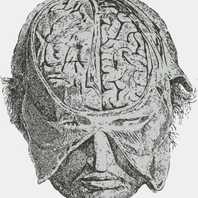 Medical Skull 12 Thumbnail